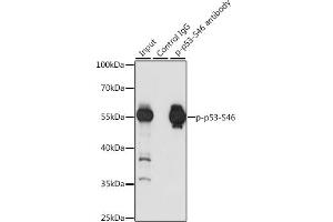 Immunoprecipitation analysis of 200 μg extracts of 293T cells, using 3 μg Phospho-p53-S46 pAb (ABIN6135270, ABIN6136162, ABIN6136163 and ABIN6225524).