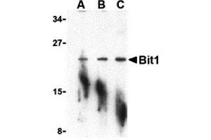 Western Blotting (WB) image for anti-Peptidyl-tRNA Hydrolase 2 (PTRH2) (N-Term) antibody (ABIN1031275) (PTRH2 anticorps  (N-Term))