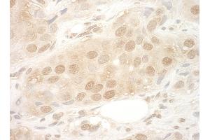 Immunohistochemistry (IHC) image for anti-Eukaryotic Translation Initiation Factor 2B, Subunit 5 Epsilon, 82kDa (EIF2B5) (AA 550-600) antibody (ABIN7454457)