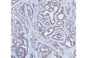 IHC analysis of Cytokeratin 20/Krt20 using anti-Cytokeratin 20/Krt20 antibody (ABIN7601133). (KRT20 anticorps  (AA 29-431))