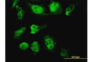 Immunofluorescence of monoclonal antibody to HOXD11 on HeLa cell. (HOXD11 anticorps  (AA 1-76))