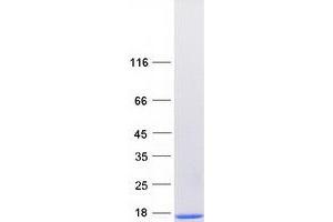 Validation with Western Blot