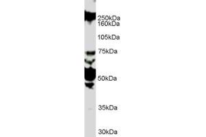 Western Blotting (WB) image for anti-Roundabout, Axon Guidance Receptor, Homolog 1 (ROBO1) (Internal Region) antibody (ABIN2466219) (ROBO1 anticorps  (Internal Region))
