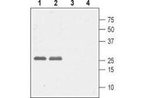 Western blot analysis of rat (lanes 1 and 3) and mouse (lanes 2 and 4) brain lysates: - 1,2. (CACNG5 anticorps  (1st Extracellular Loop))