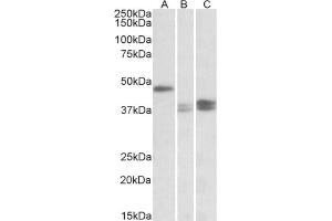 AP23763PU-N TXNDC5 antibody staining of Mouse Lymph Nodes (A), Stomach (B) and Intestine (C) lysates at 0. (TXNDC5 anticorps  (Internal Region))