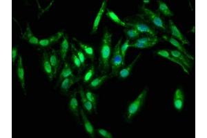 Immunofluorescence staining of Hela cells with ABIN7169262 at 1:333, counter-stained with DAPI.