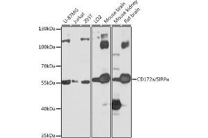 Western blot analysis of extracts of various cell lines, using CD172a/SIRPα antibody (ABIN6130058, ABIN6147780, ABIN6147781 and ABIN6224854) at 1:1000 dilution. (SIRPA anticorps  (AA 395-504))