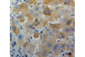 Used in DAB staining on fromalin fixed paraffin-embedded Liver tissue