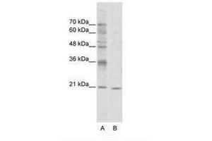 Image no. 1 for anti-Visual System Homeobox 1 (VSX1) (N-Term) antibody (ABIN202105) (VSX1 anticorps  (N-Term))