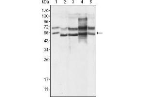 Western Blot showing using GABPA antibody used against Hela (1), A549 (2), MCF-7 (3), NIH/3T3 (4) and SMMC-7721 (5) cell lysate. (GABPA anticorps  (AA 120-190))