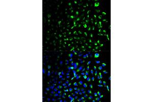 Immunofluorescence analysis of U2OS cells using HK1 antibody (ABIN5970413). (Hexokinase 1 anticorps)