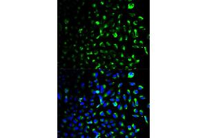 Immunofluorescence analysis of U2OS cells using HK1 antibody (ABIN5970413). (Hexokinase 1 anticorps)