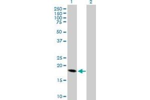 Western Blot analysis of CRH expression in transfected 293T cell line by CRH MaxPab polyclonal antibody. (CRH anticorps  (AA 1-196))