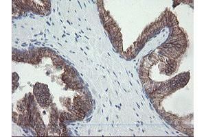 Image no. 1 for anti-Prefoldin Subunit 3 (PFDN3) antibody (ABIN1501702)