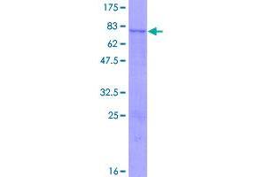 Image no. 1 for Ferredoxin Reductase (FDXR) (AA 1-491) protein (GST tag) (ABIN1353940)