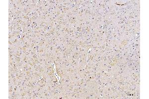 IHC analysis of DUSP6 using anti-DUSP6 antibody (ABIN7599332). (DUSP6 anticorps  (AA 1-381))