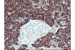 Image no. 4 for anti-Carboxypeptidase A2 (Pancreatic) (CPA2) antibody (ABIN1497594) (Carboxypeptidase A2 anticorps)