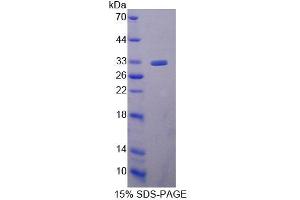SDS-PAGE (SDS) image for Ubiquitin-Conjugating Enzyme E2S (UBE2S) (AA 1-223) protein (His tag) (ABIN6239560)