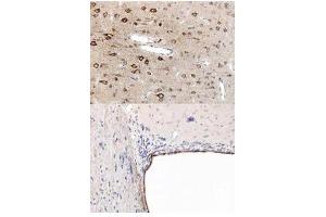 Immunohistochemistry (IHC) image for anti-Peroxisome Proliferator-Activated Receptor alpha (PPARA) (N-Term) antibody (ABIN1043876) (PPARA anticorps  (N-Term))