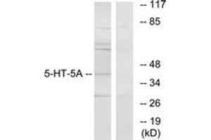 Western Blotting (WB) image for anti-Serotonin Receptor 5A (HTR5A) (AA 211-260) antibody (ABIN2889849) (Serotonin Receptor 5A anticorps  (AA 211-260))