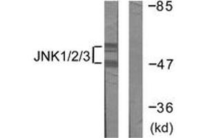 Western blot analysis of extracts from 293 cells, treated with UV 5', using JNK1/2/3 (Ab-183/185) Antibody. (JNK anticorps  (AA 151-200))