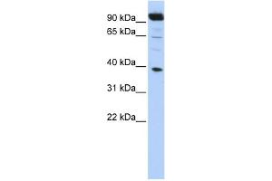 WB Suggested Anti-HOXB2 Antibody Titration:  0.