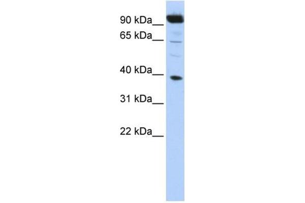 HOXB2 anticorps  (N-Term)
