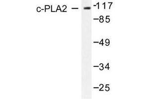 Image no. 2 for anti-Phospholipase A2, Group IVB (Cytosolic) (PLA2G4B) antibody (ABIN271921) (PLA2G4B anticorps)