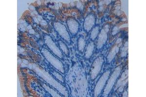 Used in DAB staining on fromalin fixed paraffin- embedded intestine tissue