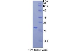 SDS-PAGE analysis of Mouse Toll Like Receptor 3 Protein. (TLR3 Protéine)