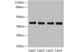Western blot All lanes: NUDT9 antibody at 8 μg/mL Lane 1: Raji whole cell lysate Lane 2: Jurkat whole cell lysate Lane 3: Mouse kidney tissue Lane 4: Hela whole cell lysate Secondary Goat polyclonal to rabbit IgG at 1/10000 dilution Predicted band size: 40, 34 kDa Observed band size: 40 kDa