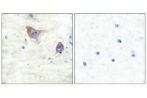 Immunohistochemical analysis of paraffin-embedded human brain tissue using Synuclein β antibody. (beta Synuclein anticorps)