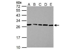 WB Image HMGB1 antibody detects HMGB1 protein by Western blot analysis. (HMGB1 anticorps)