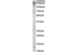 Image no. 2 for anti-TBC1 Domain Family, Member 4 (TBC1D4) (Internal Region) antibody (ABIN374867) (TBC1D4 anticorps  (Internal Region))
