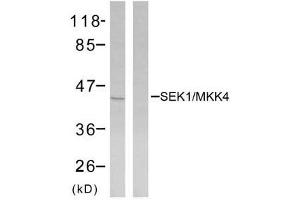 Western blot analysis of extracts from NIH/3T3 cells using SEK1/MKK4 (Ab-80) antibody (E021132). (MAP2K4 anticorps)
