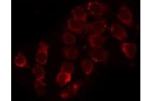 ABIN6279061 staining HepG2 by IF/ICC.