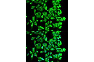 Immunofluorescence analysis of U2OS cells using HSP90AB1 antibody. (HSP90AB1 anticorps)