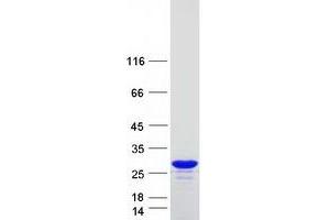 Validation with Western Blot