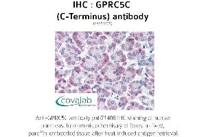 Image no. 1 for anti-G Protein-Coupled Receptor, Family C, Group 5, Member C (GPRC5C) (C-Term), (Cytoplasmic Domain) antibody (ABIN1735219) (GPRC5C anticorps  (C-Term, Cytoplasmic Domain))