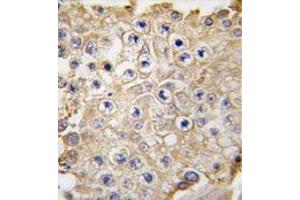 Formalin-fixed and paraffin-embedded human testis tissue reacted with APPBP1 antibody (C-term) , which was peroxidase-conjugated to the secondary antibody, followed by DAB staining. (NAE1 anticorps  (C-Term))