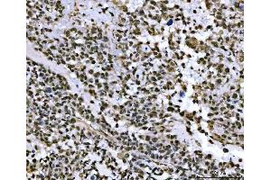 IHC analysis of THAP11 using anti-THAP11 antibody (ABIN7599230). (THAP11 anticorps  (AA 1-294))