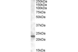 Western Blotting (WB) image for anti-RAB17, Member RAS Oncogene Family (RAB17) (AA 102-115) antibody (ABIN490469) (RAB17 anticorps  (AA 102-115))