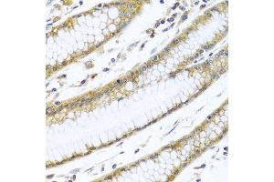Immunohistochemistry of paraffin-embedded human stomach using GNAI3 antibody at dilution of 1:100 (40x lens). (GNAI3 anticorps)