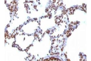 IHC testing of FFPE rat lung with Nuclear Antigen antibody. (Nuclear Antigen anticorps)