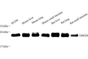 Western blot analysis of TMED9 (ABIN7075988),at dilution of 1: 4000 (TMED9 anticorps)