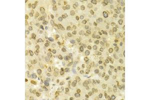 Immunohistochemistry (IHC) image for anti-Lamin B1 (LMNB1) (AA 397-586) antibody (ABIN3015698)