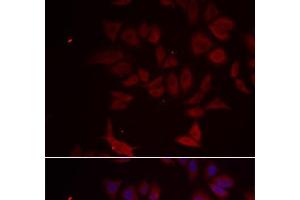 Immunofluorescence analysis of MCF-7 cells using RPL11 Polyclonal Antibody (RPL11 anticorps)