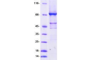 Validation with Western Blot