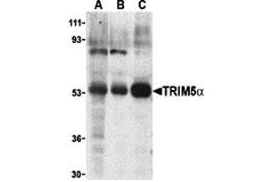 Western Blotting (WB) image for anti-Tripartite Motif Containing 5 (TRIM5) (Middle Region 2) antibody (ABIN1031206) (TRIM5 anticorps  (Middle Region 2))