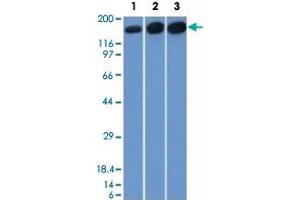 Western Blot analysis of Lane 1: HepG2, Lane 2: HeLa and Lane 3: 3T3 cell lysates with TOP2A monoclonal antibody, clone TOP2A/1361 . (Topoisomerase II alpha anticorps  (AA 1352-1493))